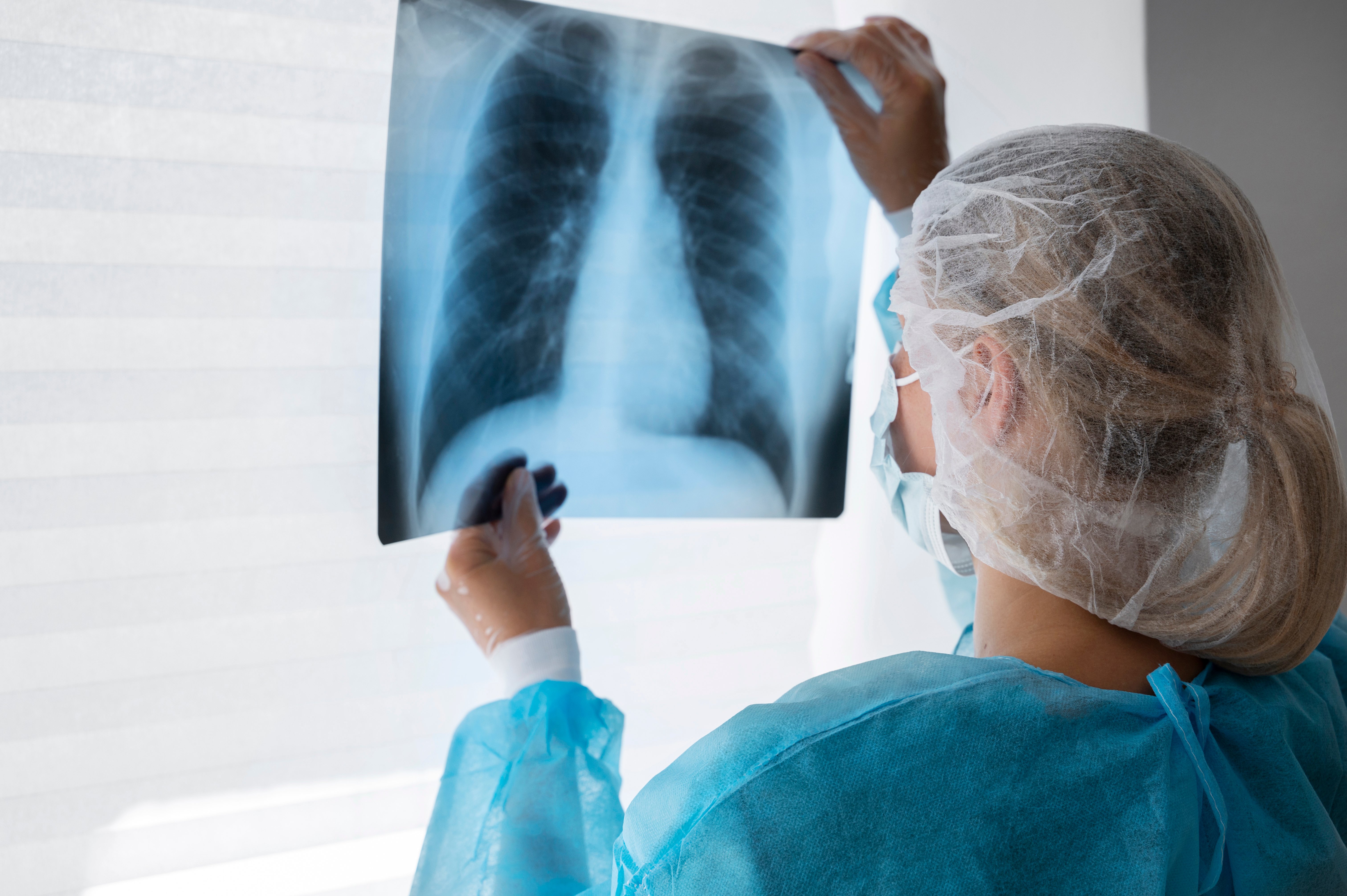 Cáncer de pulmón: una amenaza silenciosa que sigue cobrando vidas